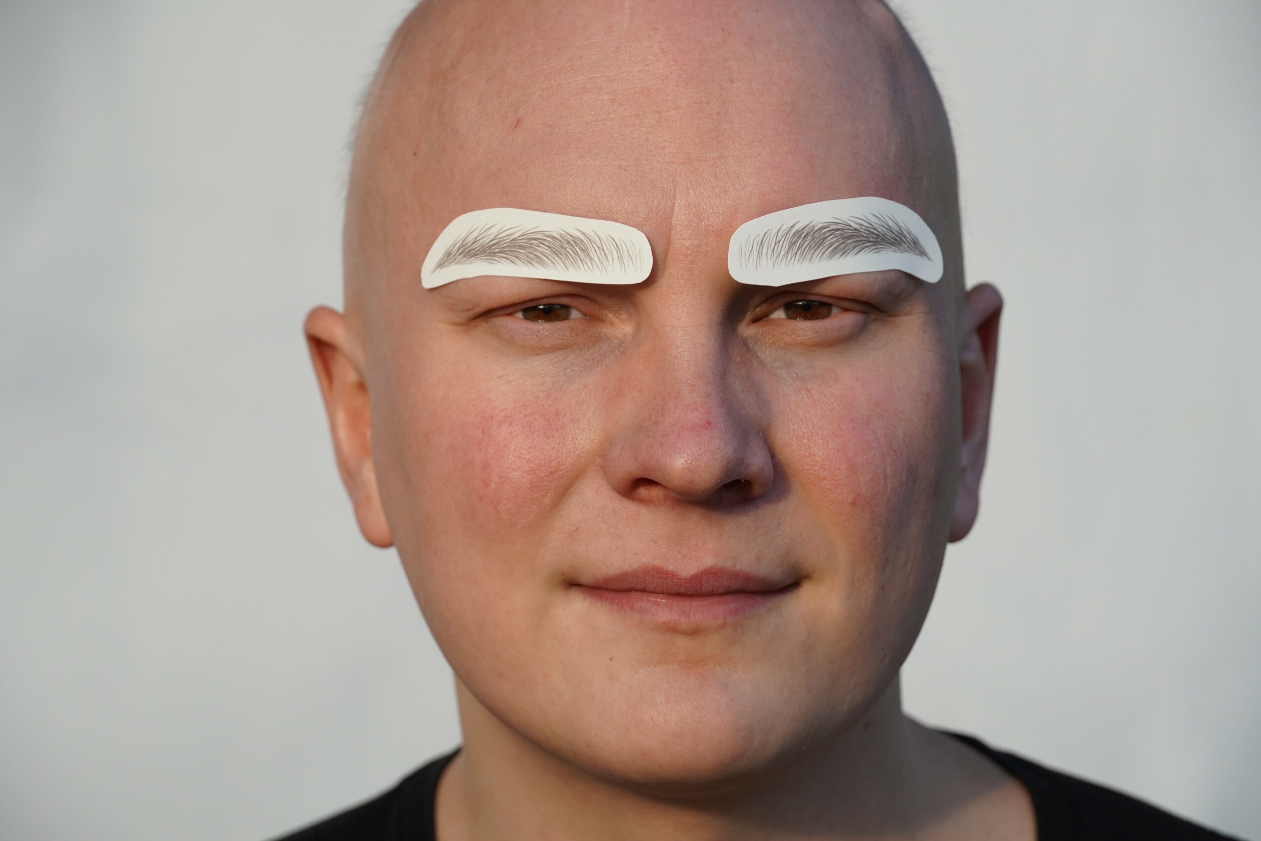 Person with bald head and large white eyebrows, neutral expression, light background.