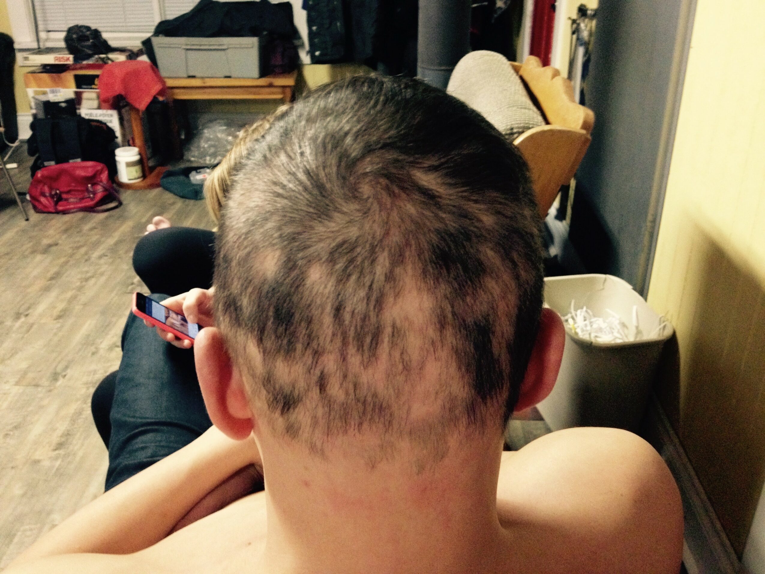 Back of person's head with short, thinning hair and visible scalp, in a room with furniture and belongings.