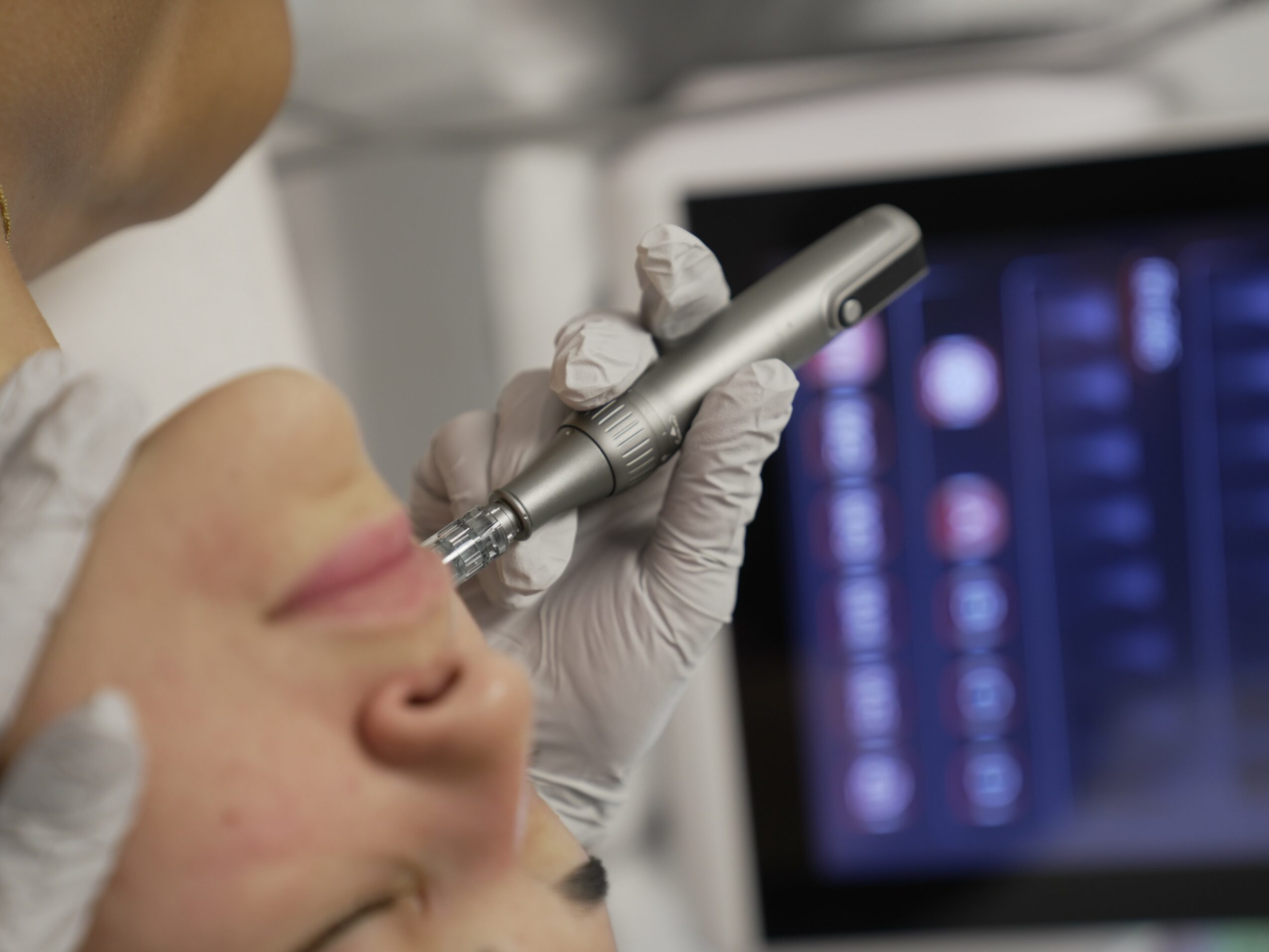 Close-up of a person receiving a cosmetic treatment with a handheld device, with a screen displaying medical data in the background.