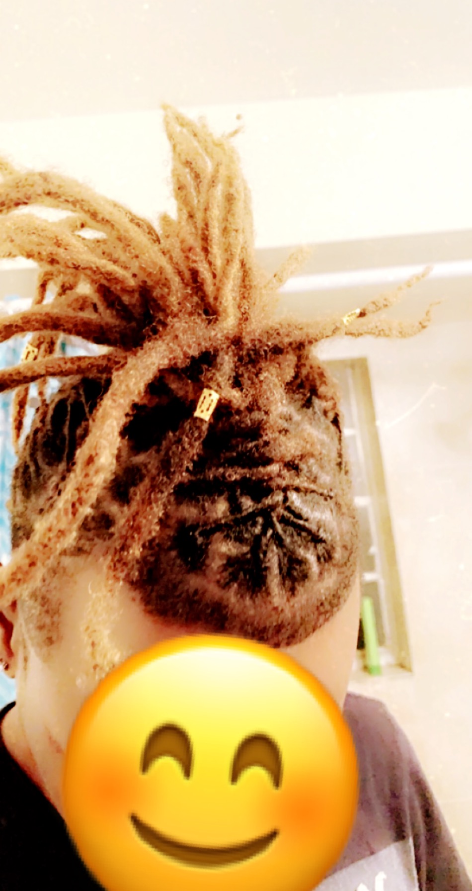 Person with dreadlocks and a smiley face emoji covering their face, indoors with a white wall and window in background.