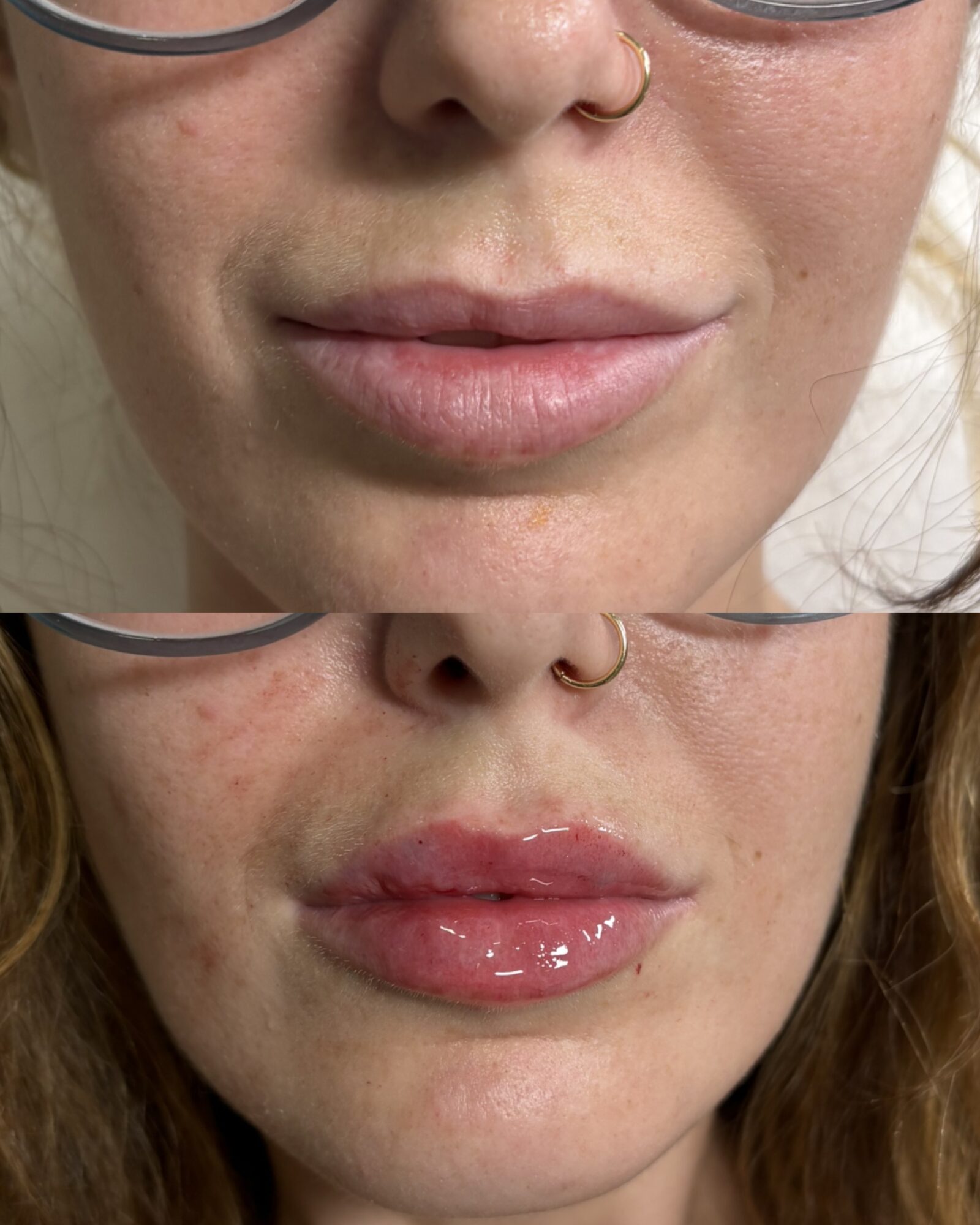 Close-up of two women's faces, focusing on lips and noses, with one wearing glasses and a nose ring, the other with glossy lips.